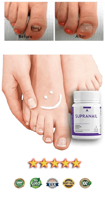 Ikaria Lean Belly Juice supranail official website